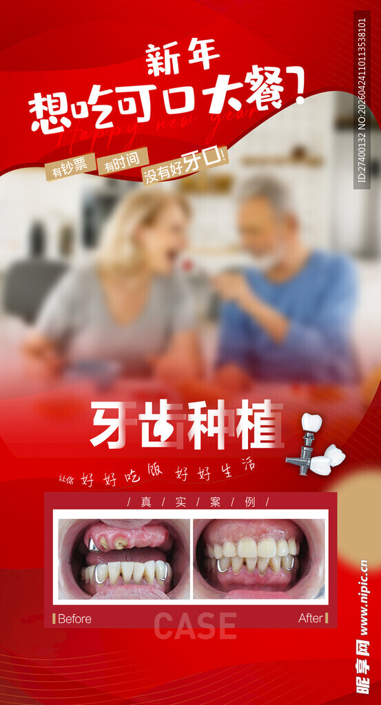 牙齿矫正新科技