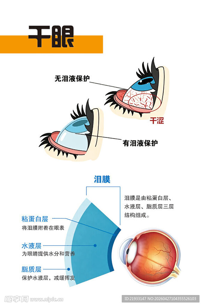 干眼