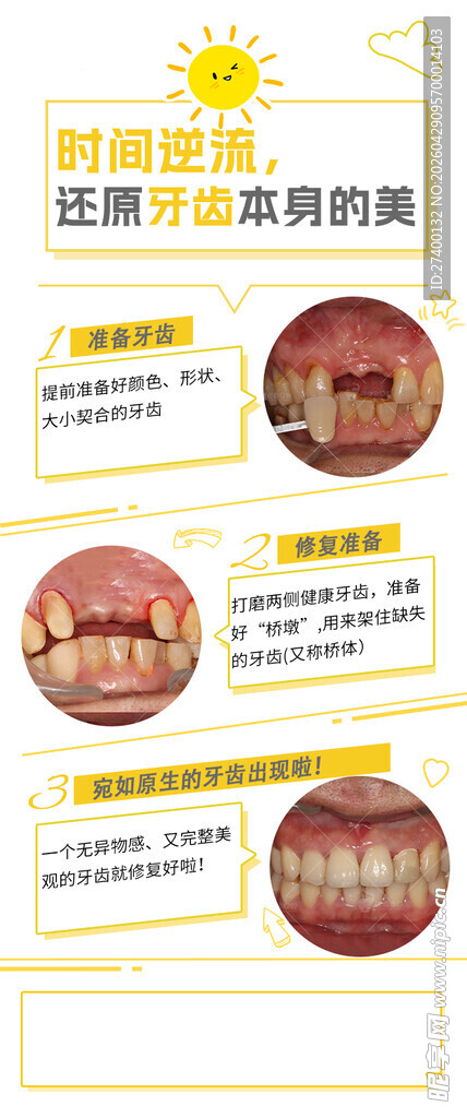婴儿湿疹护理对比图