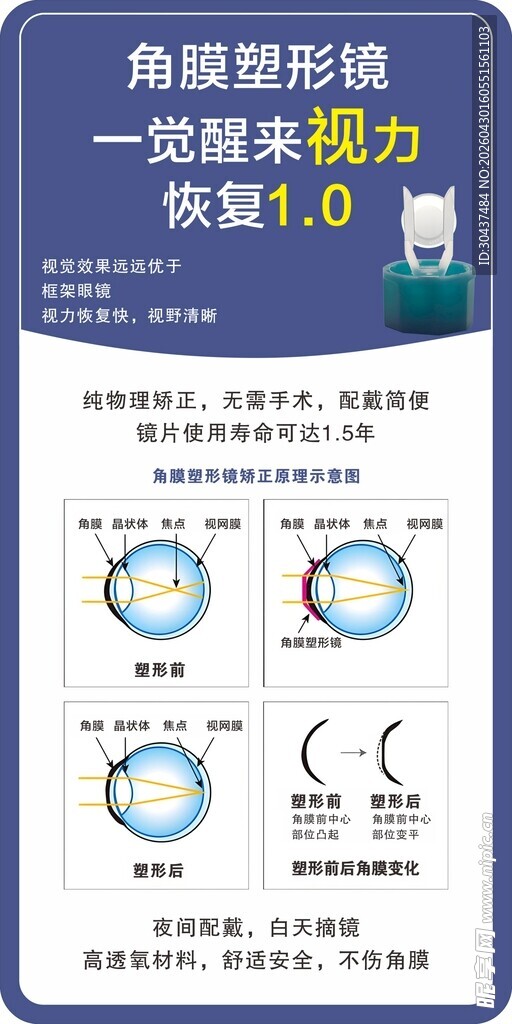 角膜塑形镜