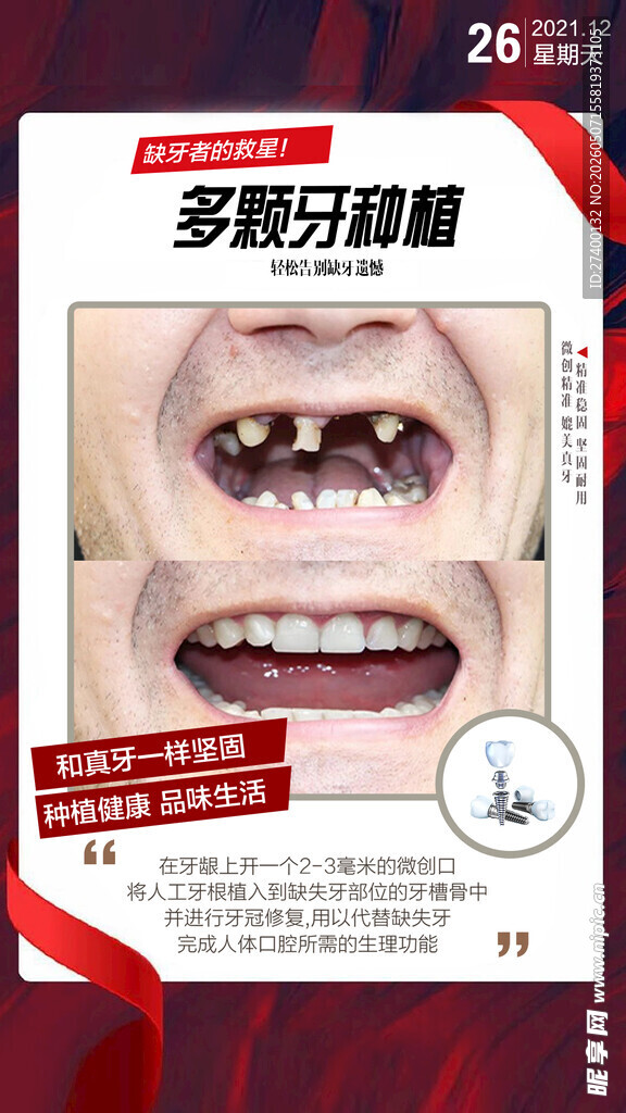 多效牙齿贴焕亮笑容
