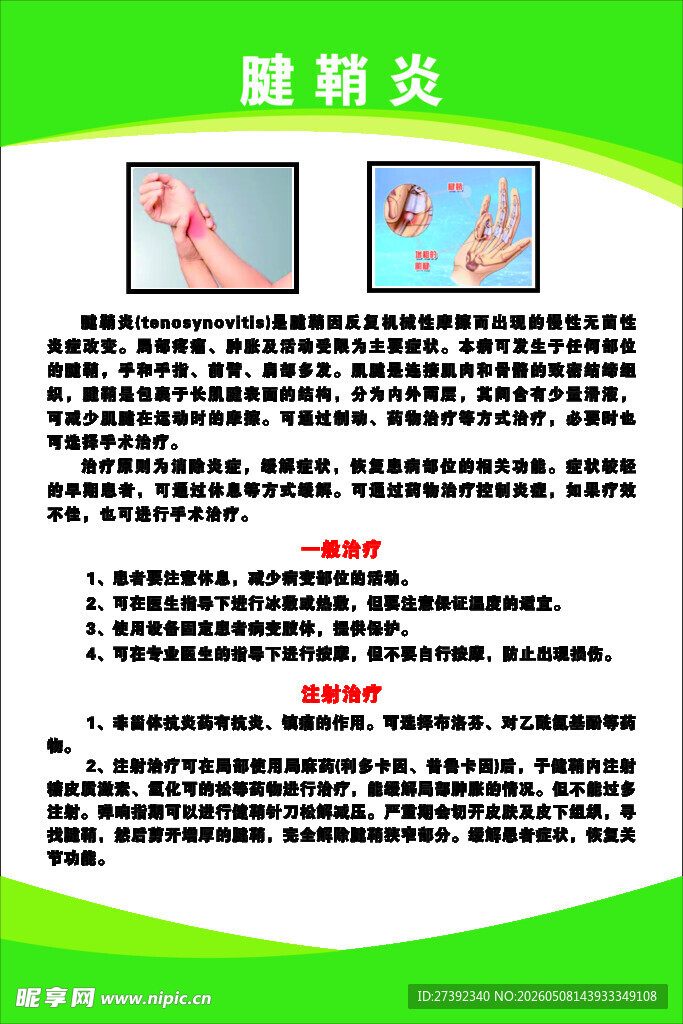 腱鞘炎知识科普海报
