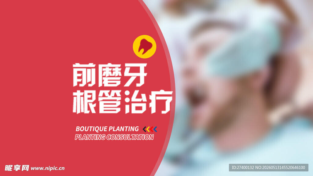 牙髓治疗预售优惠