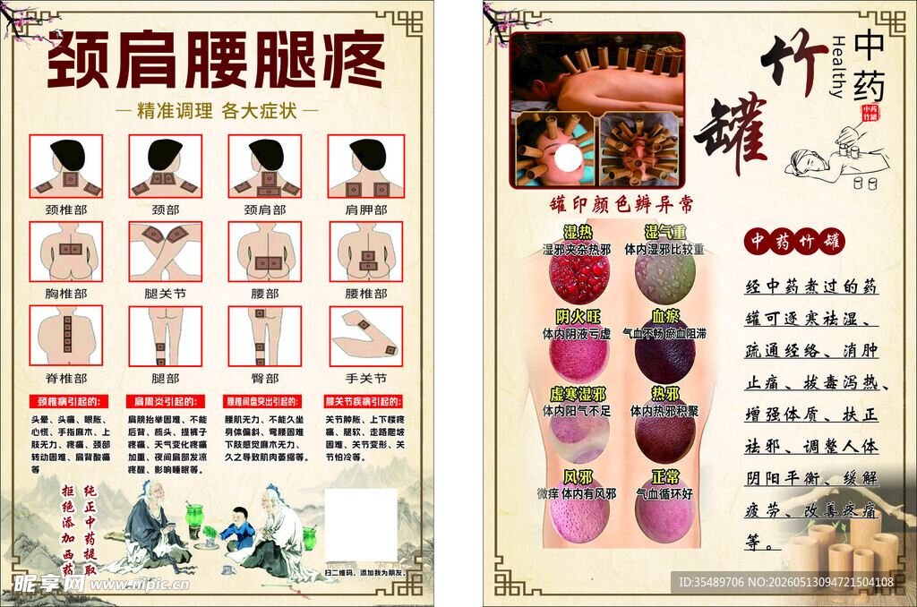 疼痛 养生 竹罐 拔罐