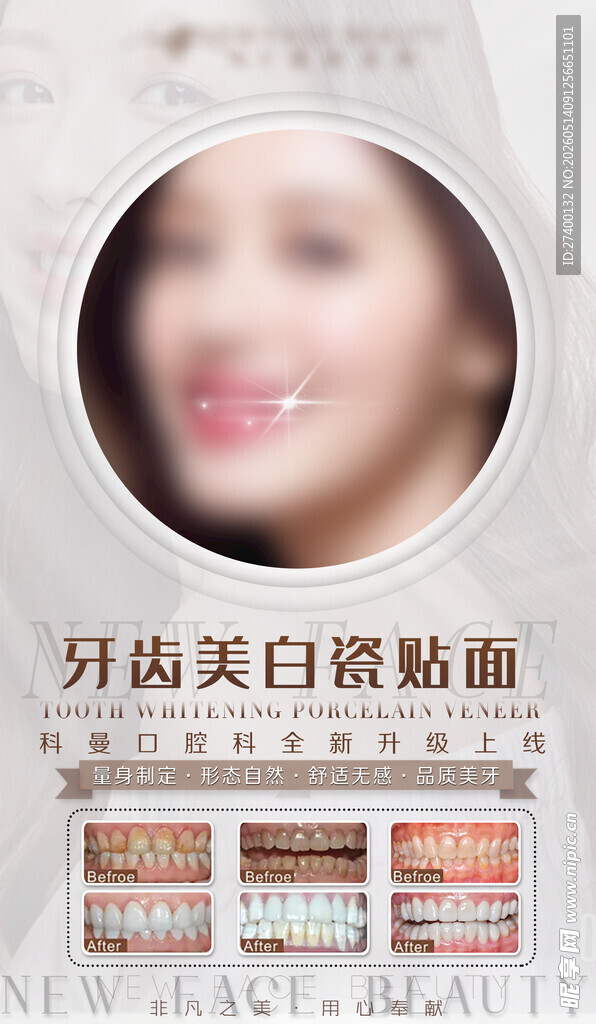 牙齿美白瓷贴面展示