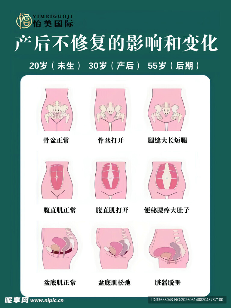 产后不修复的形态变化