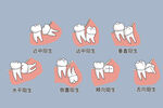 牙齿常见智齿阻生图片