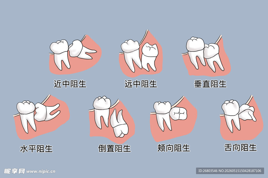 牙齿常见智齿阻生图片