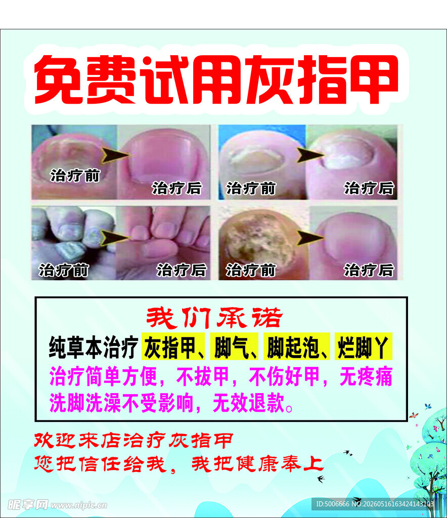 灰指甲