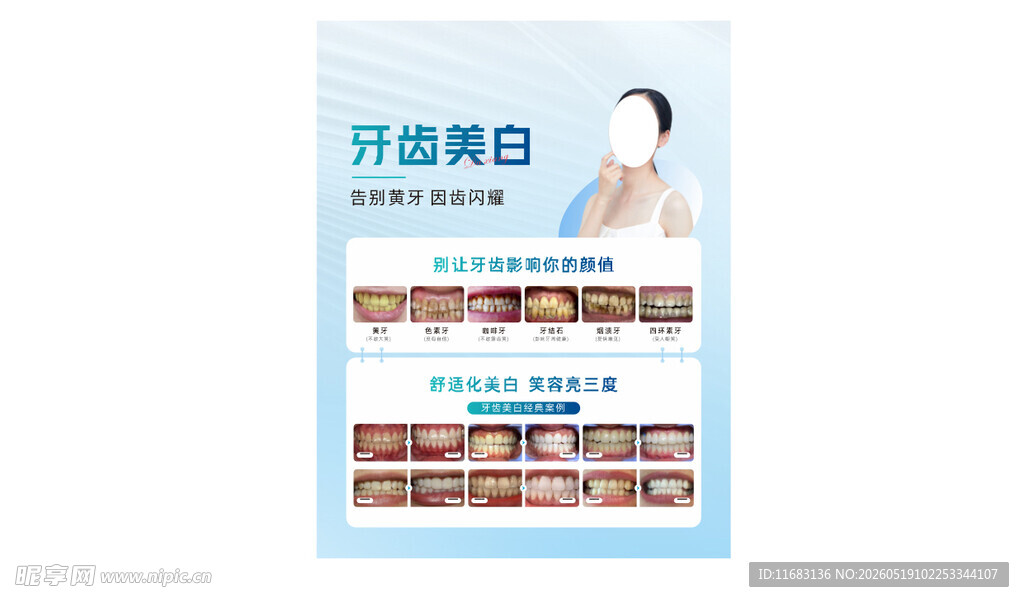 牙齿美白