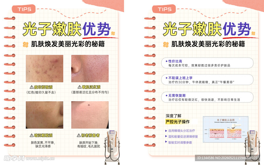 光子嫩肤科普