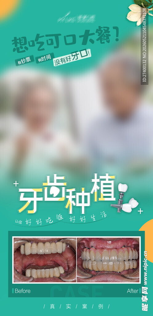 牙齿种植宣传海报