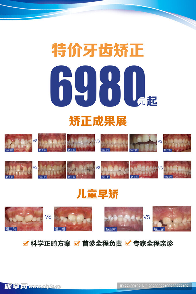 特价牙齿矫正6980起