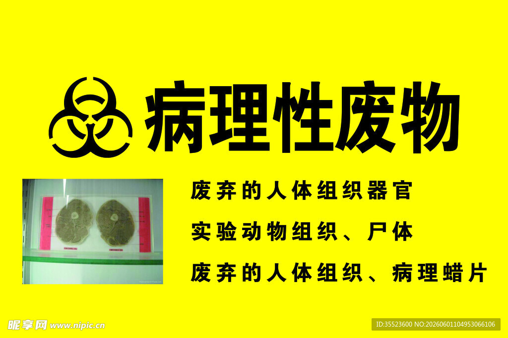 病理性废物标识牌展示