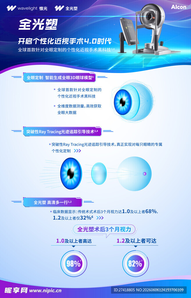 全眼激光矫正手术