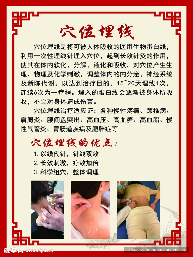 穴位埋线疗法介绍
