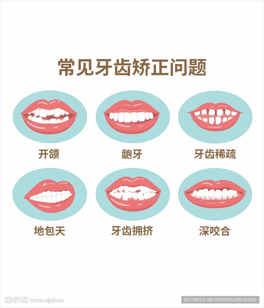 常见牙齿矫正问题展示