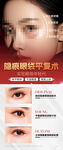 眼部整形手术效果展示