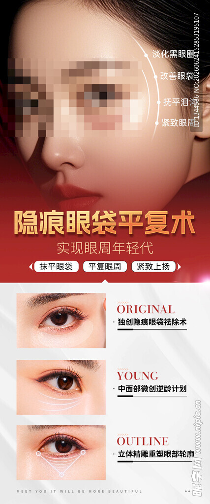 眼部整形手术效果展示