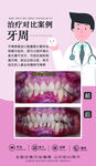 牙周治疗前后对比图
