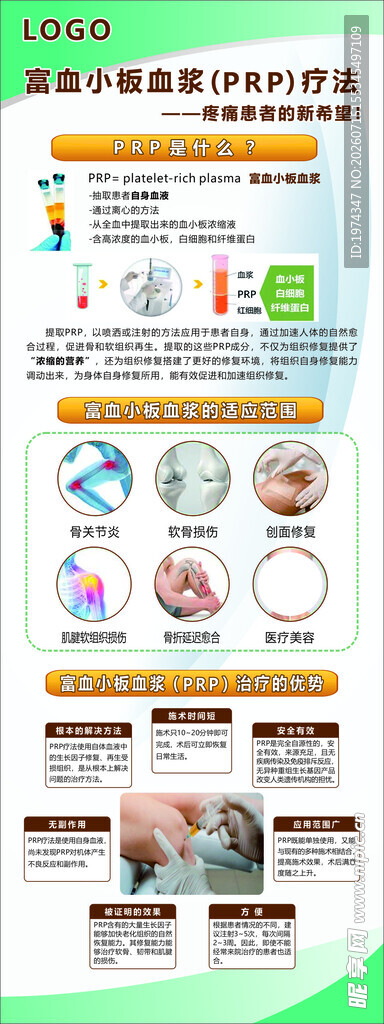 富血小板血浆PRP疗法