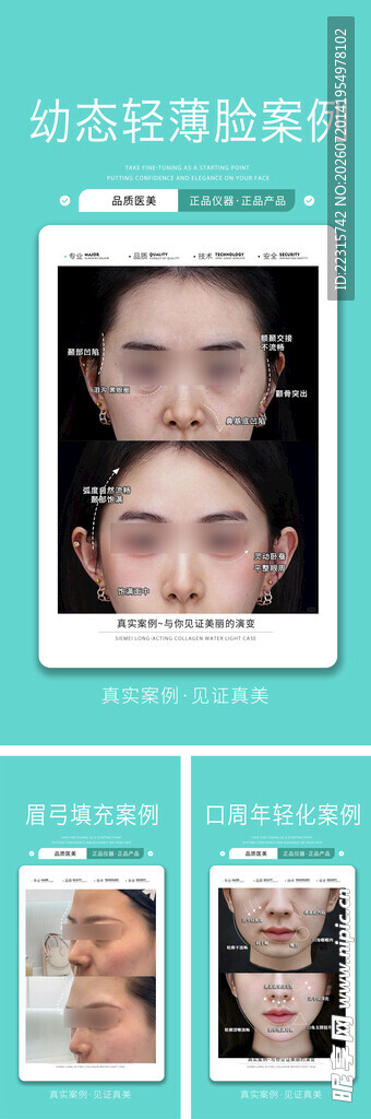 医美案例海报