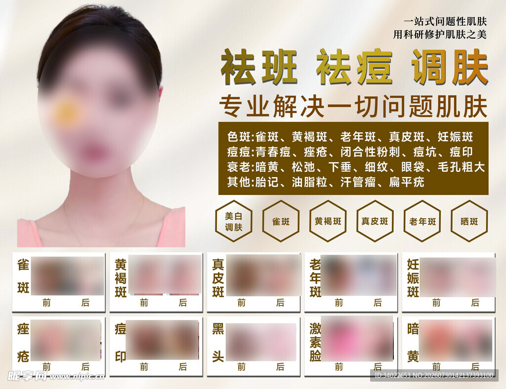 祛斑祛痘 肌肤焕新方案