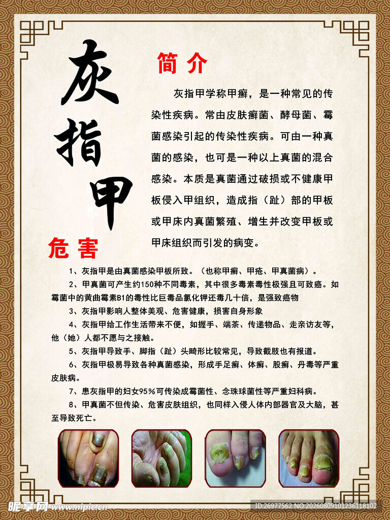 灰指甲