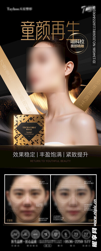 眼部整形前后对比展示