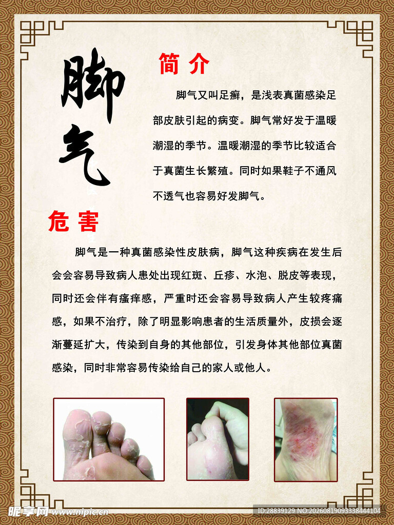 脚气 