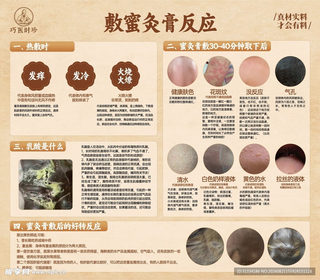敷蜜灸膏反应 
