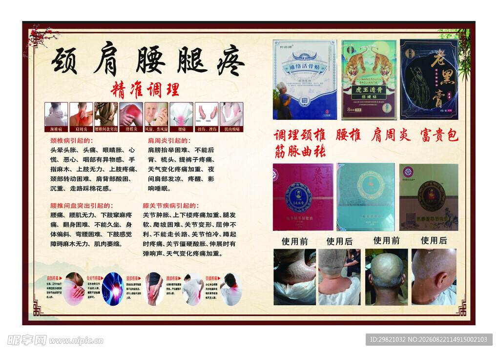 颈肩腰腿疼治疗介绍