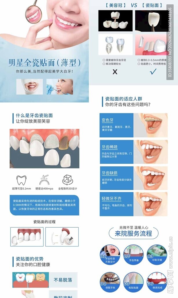 全瓷贴面