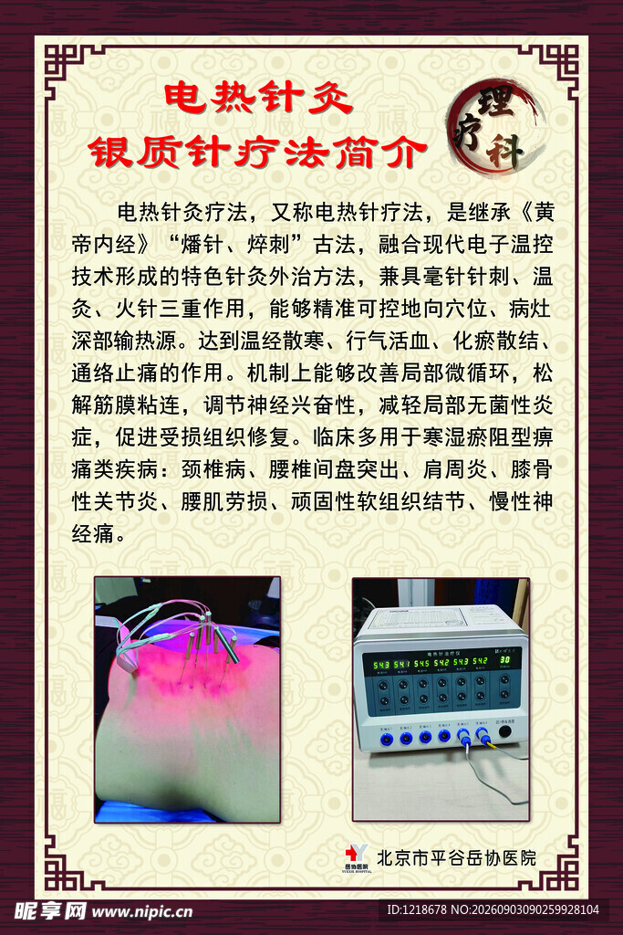 电热针灸银质针疗法