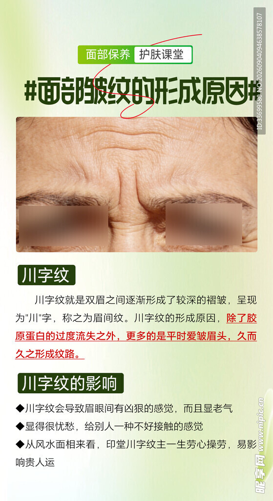 眼睑皱纹注射治疗指南