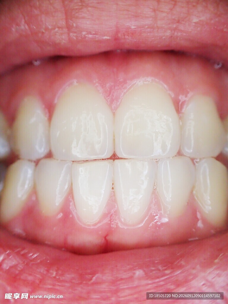 健康洁白的人类牙齿