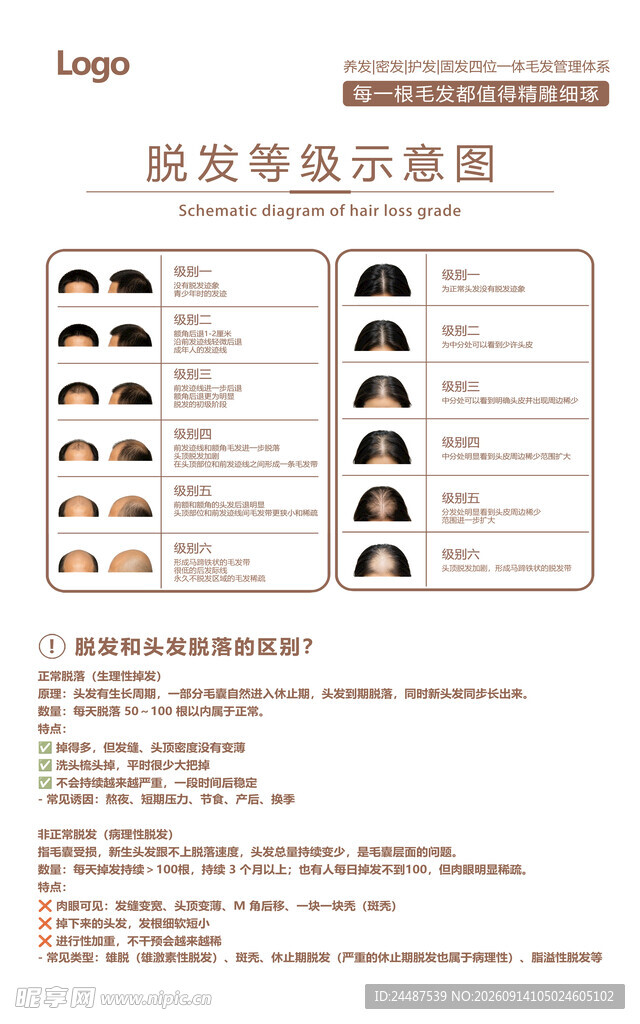 男女脱发等级示意图