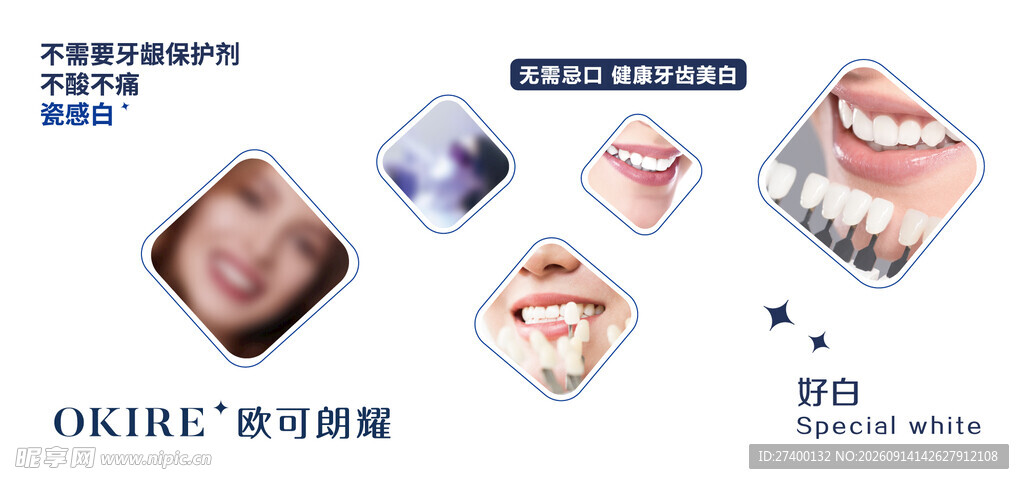 牙齿矫正案例展示