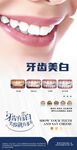 牙齿美白产品宣传海报