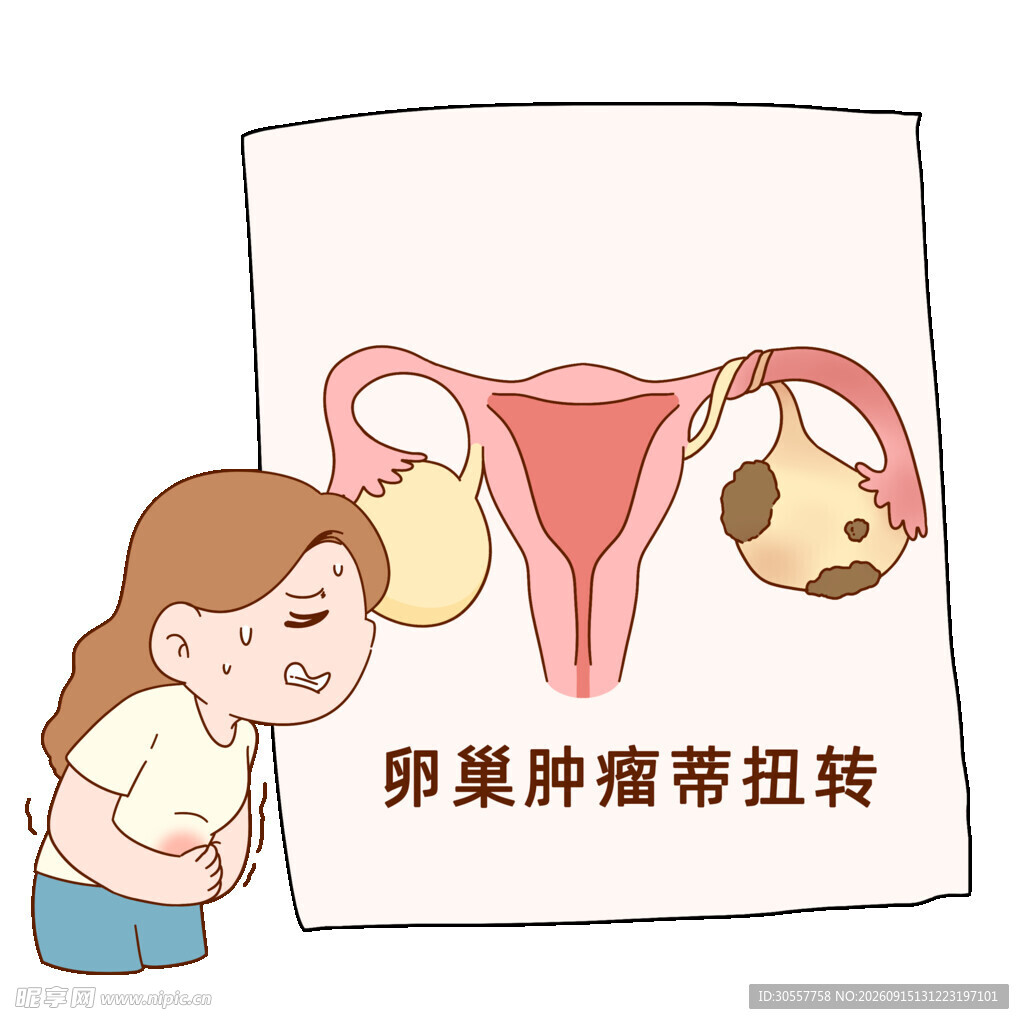 卵巢肿瘤妇科疾病漫画