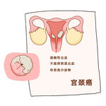 女性健康宫颈癌妇科疾病漫画