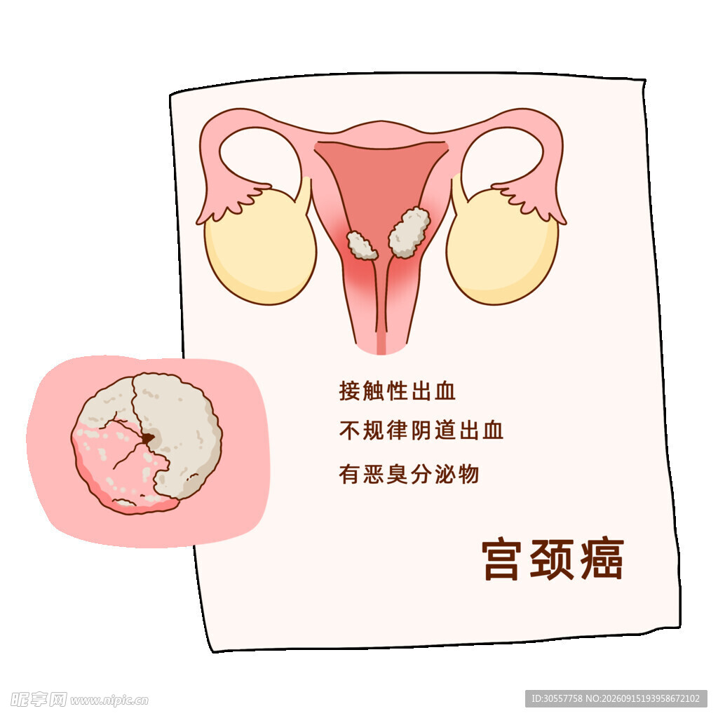 女性健康宫颈癌妇科疾病漫画