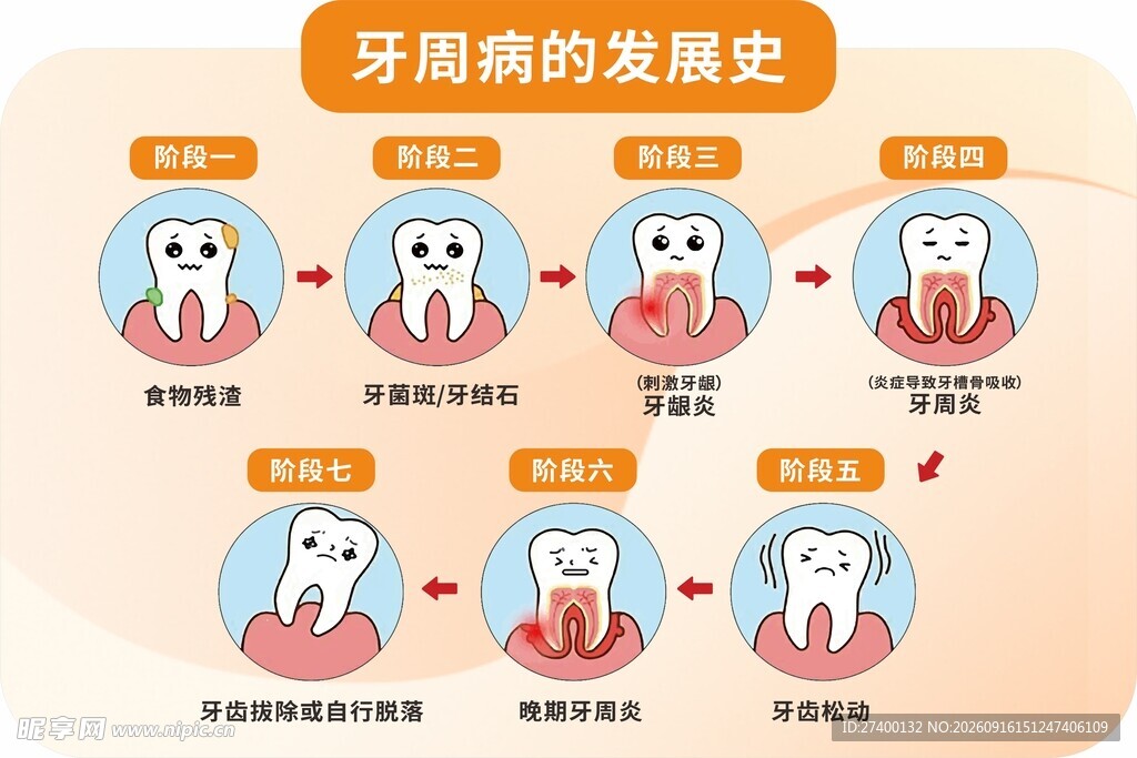 牙齿龋病发展史图示