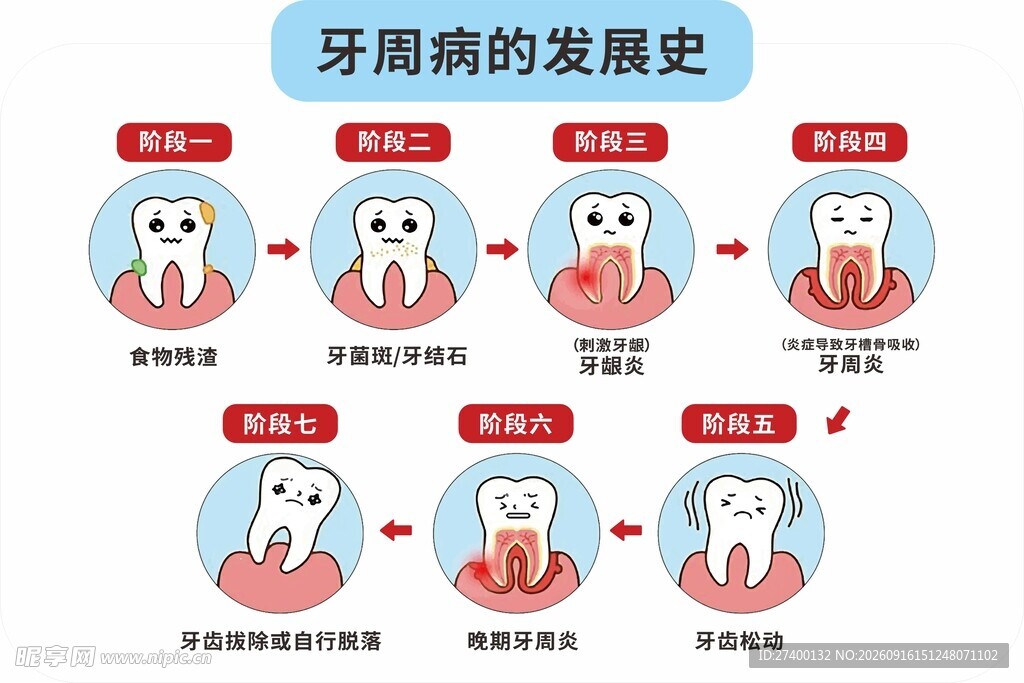 牙周病发展史图示