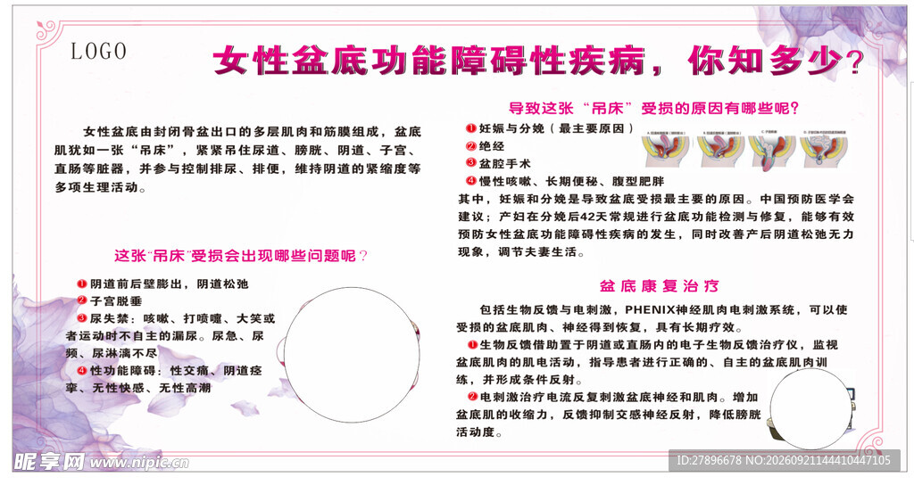 女性盆底功能障碍性疾病知识展板