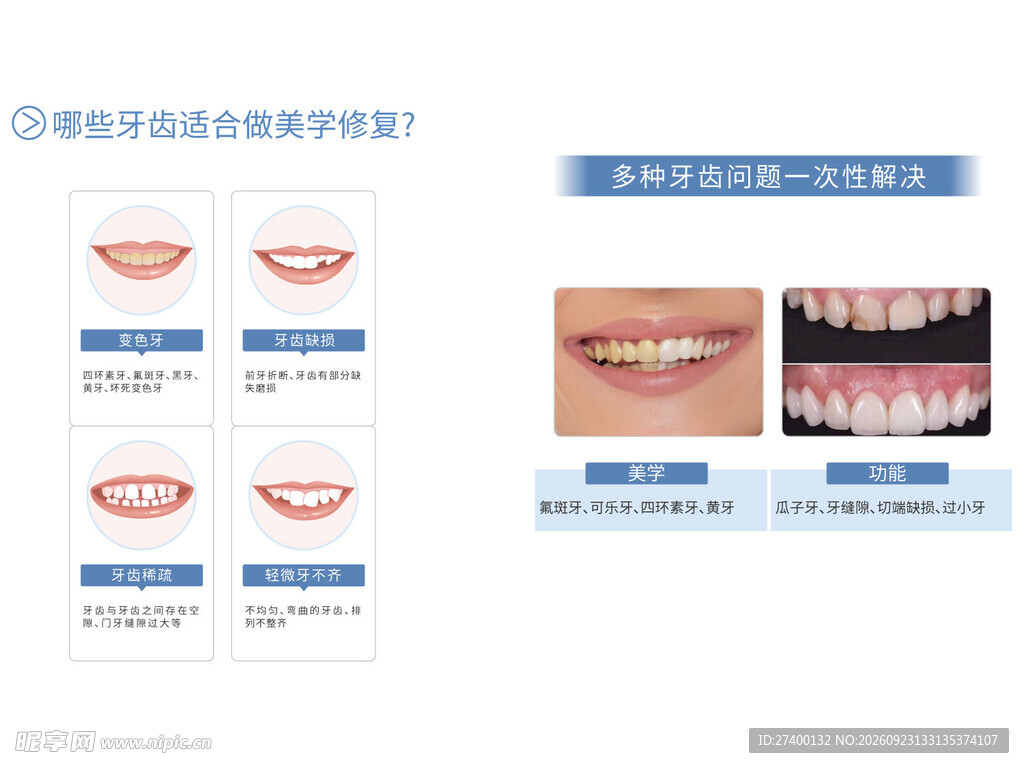 牙齿美学修复科普