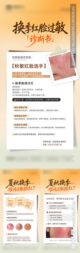 换季护肤小知识