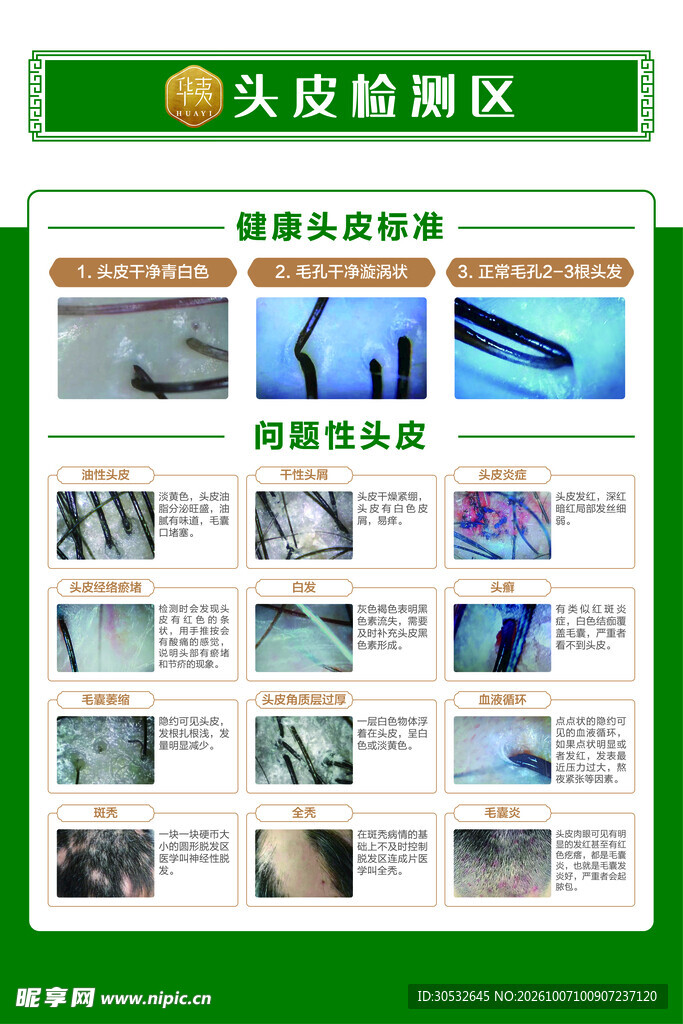 头皮检测