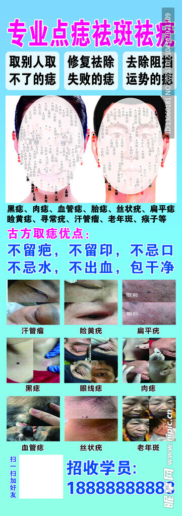 专业点痣祛斑祛疣宣传