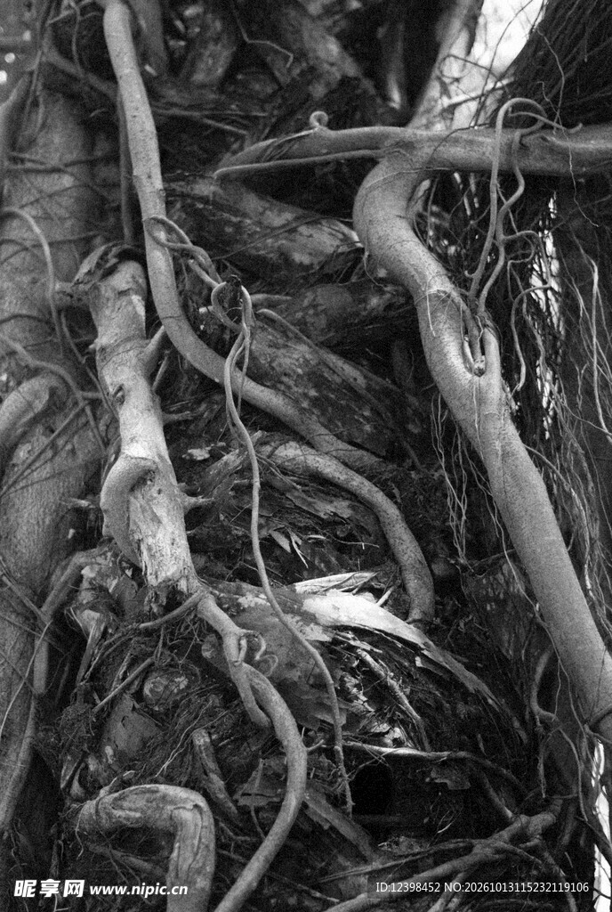 血管造影